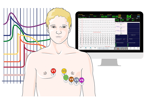 Electrocardiogram