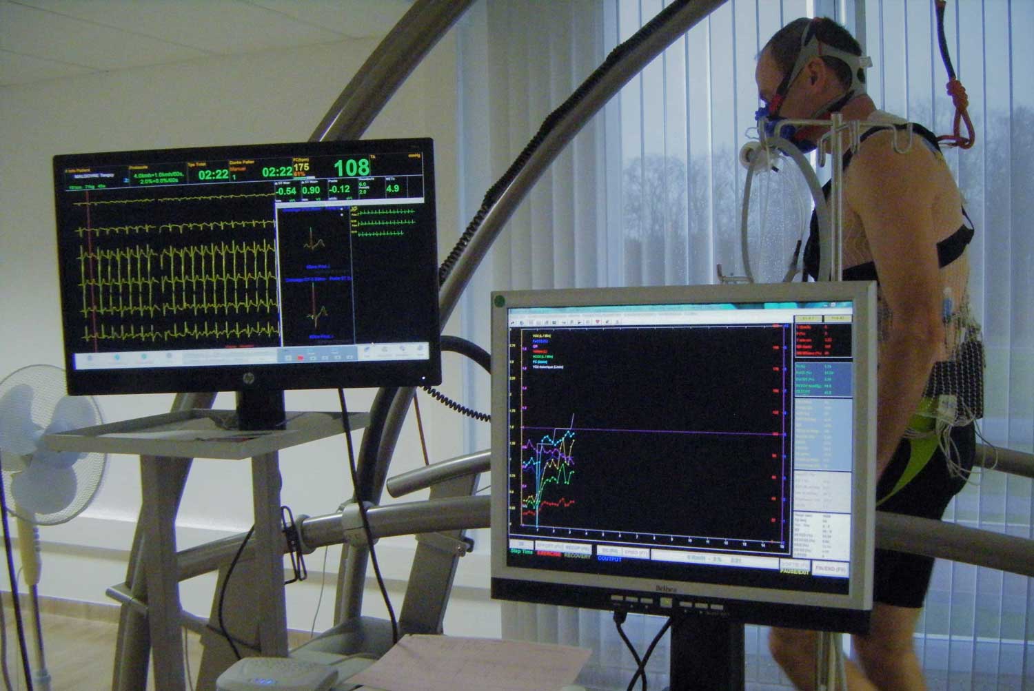 Epreuve d'effort sur tapis avec écran VO2 et ECG
